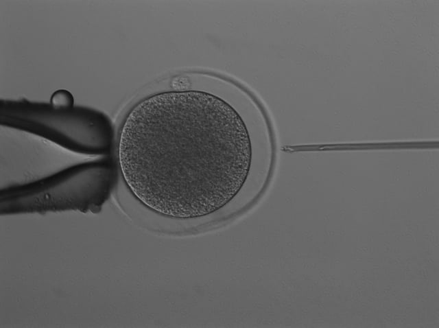A team of researchers have recently produced the world’s first kangaroo embryo through IVF, the University of Queensland said Thursday.