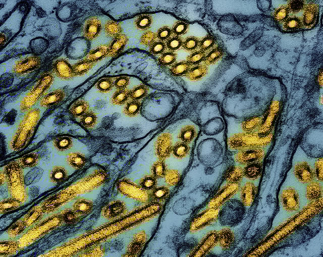 FILE -This colorized electron microscope image released by the National Institute of Allergy and Infectious Diseases on March 26, 2024, shows avian influenza A H5N1 virus particles (yellow), grown in Madin-Darby Canine Kidney (MDCK) epithelial cells (blue). 
