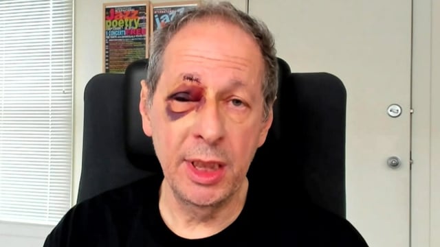 Henry Reese soon after the incident in 2022