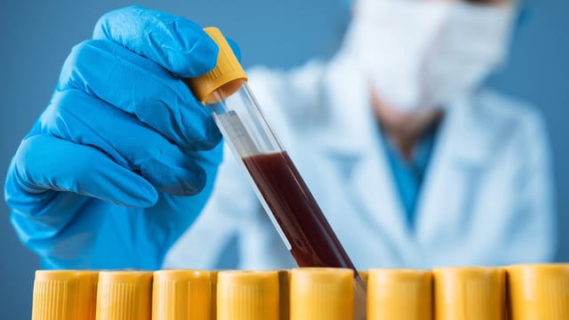 The test analyses blood and urine samples