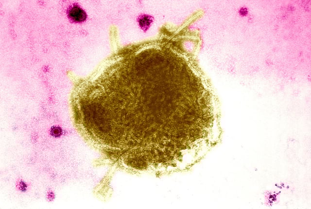Estimates say that up to 3 in 1,000 children who get measles will die of respiratory and neurologic complications.