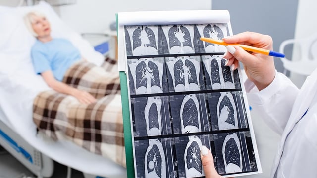 The NHS has written to more than 5,000 people who should have been tested for cancer