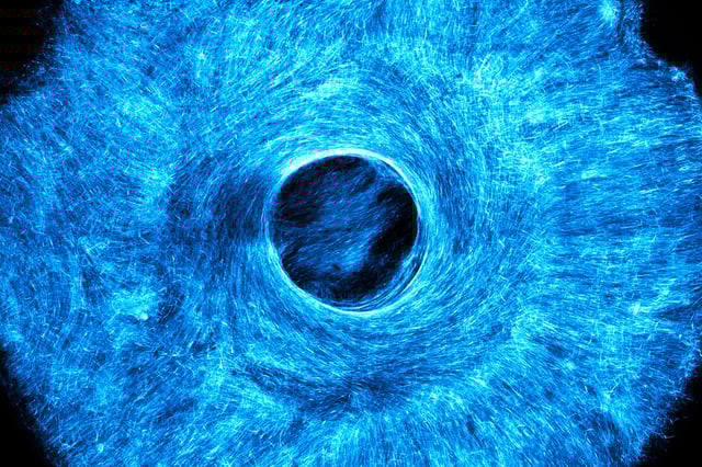 MIT engineers grew an artificial, muscle-powered structure that pulls both concentrically and radially, much like how the iris in the human eye acts to dilate and constrict the pupil.