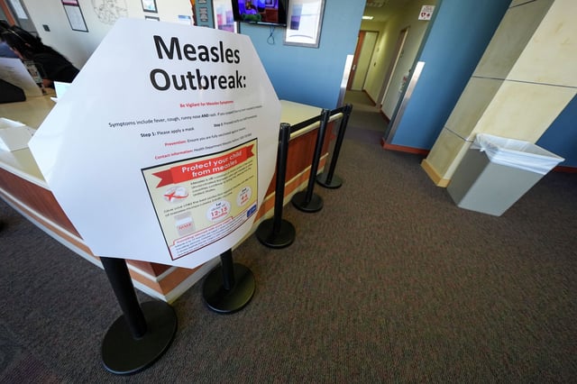 A measles sign is seen at the Texas Tech University Health Sciences Center Tuesday, Feb. 25, 2025, in Lubbock, Texas. 