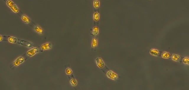 Die zum Leben erweckte Kieselalge Skeletonema marinoi