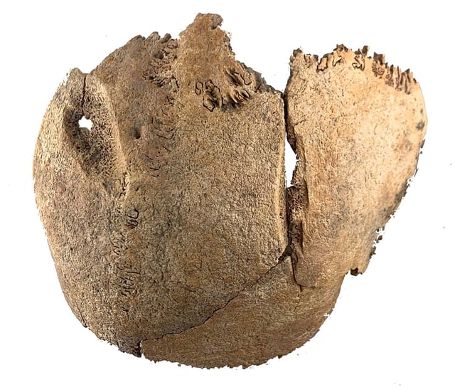 Sharp trauma was found on the skull of an individual.