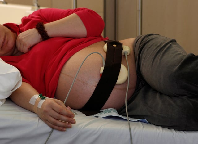 A pregnant woman is monitored with a cardiotocograph shortly before the birth of her baby at the Munich hospital 'Rechts der Isar' January 18, 2011.   REUTERS/Michaela Rehle/File Photo