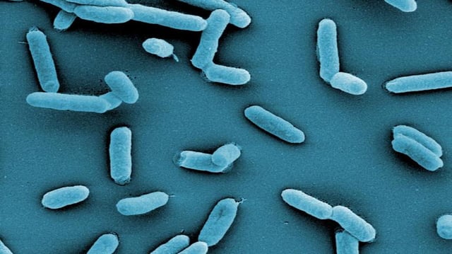 Salmonella enterica serovar Thyphimurium. Credit: HZI/Manfred Rohde