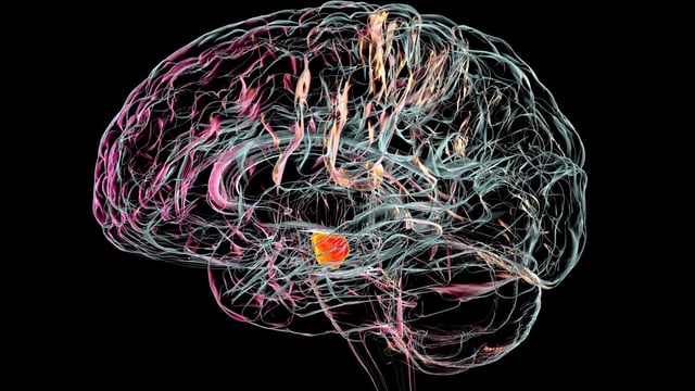 Parkinson’s is caused by a loss of nerve cells in a part of the brain called the substantia nigra