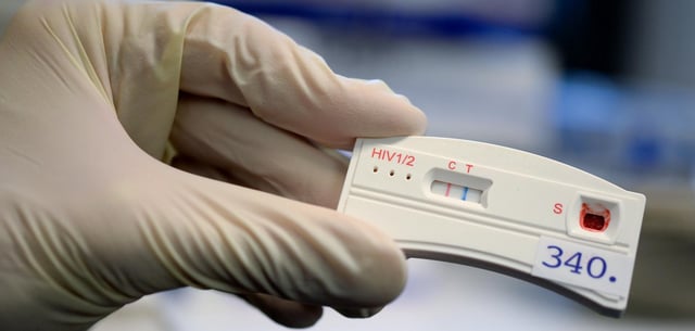 Der Teststreifen an einem HIV-Schnelltest