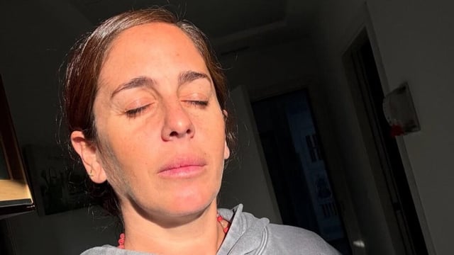 La celebrity ha explicado en sus redes sociales el motivo de su reciente intervención