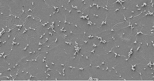 The bacteria-laden surface of a steel plate that was painted with a control resin that did not contain the active ingredient, chlorhexidine digluconate (CHX)