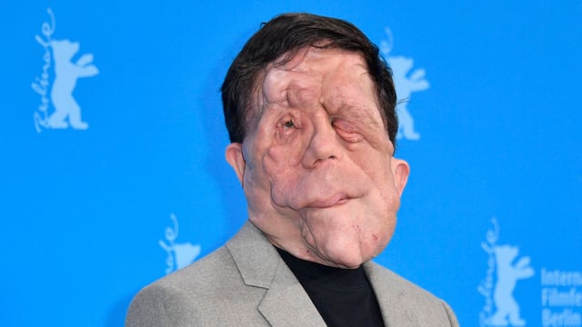 Adam Pearson