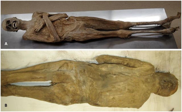 External appearance of the mummy from the ventral (A) and dorsal side (B) showing a completely intact body wall .