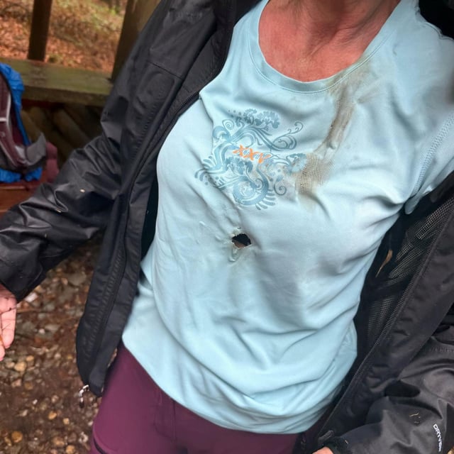 Ein Bild der geretteten Frau – in der Mitte des T-Shirts ist ein Brandloch zu erkennen