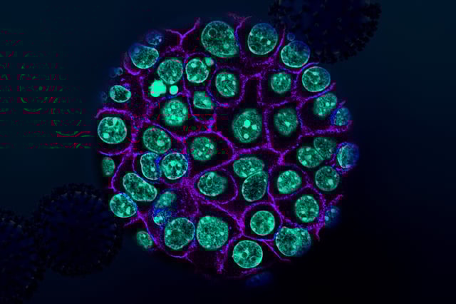 “Pancreas cancer is one of the most challenging cancers to treat. This study identifies an unexpected vulnerability in pancreas cancer cells that we may be able to exploit therapeutically,” says Tyler Jacks.
