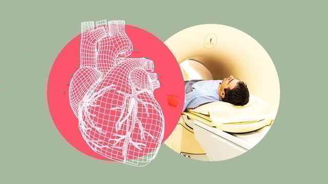 Scans could identify people at risk of cardiovascular disease who may have no other identifiable risk factors