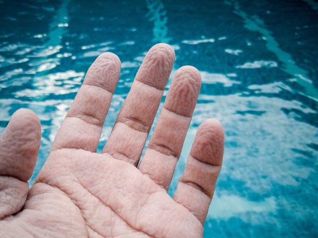 When your fingers get pruney, they form the same wrinkle patterns. (SharkPaeCNX/Shutterstock)