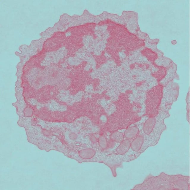 Electron microscopy image of young naïve CD8+ T cells. Credit: Helen Hope / UNIL (2025)
