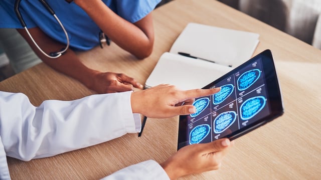 Doctors looking at a scan of the brain.