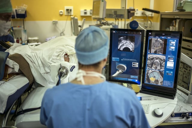 A surgeon sitting in front of screens of a Focal Onedevice performs a robot-assisted prostate tumorectomy using ultrasound imaging on April 10, 2014 at the Edouard Herriot hospital in Lyon, center France. Focal One is the first robotic HIFU (high intensity focused ultrasound) device dedicated to the focal approach for prostate cancer therapy. According to EDAP TMS SA, a leader in therapeutic ultrasound, it combines the three essential components to efficiently perform a focal treatment: state-of-the-art imaging to localized tumors with the use of magnetic resonance imaging (MRI) combined with real-time ultrasound, utmost precision of robotic HIFU treatment focused only on identified targeted cancer areas, and immediate feedback on treatment efficacy utilizing Contrast-Enhanced Ultrasound Imaging. AFP PHOTO / JEFF PACHOUD (Photo credit should read JEFF PACHOUD/AFP/Getty Images)