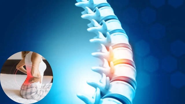 Woman Who Avoided Sunlight Since Childhood Breaks Bones While Sleeping; Other Side Effects of Vitamin D Deficiency