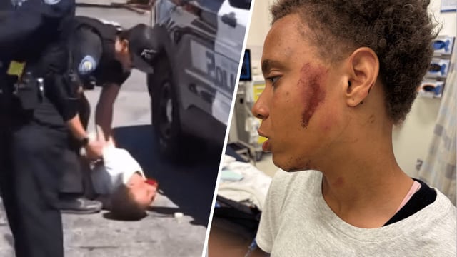 A San Bernardino police officer left a 17-year-old girl with a dislocated wrist and required her to get stitches on her face after he slammed her to the ground during an arrest on Wednesday, May 21, 2025.