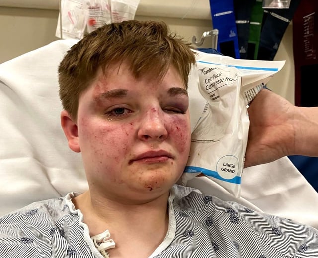 Kady Grass provided this photo taken at Advocate Sherman Hospital in Elgin to show the injuries she received in a May 13, 2025, fight with two teens who allegedly used a gay slur and attacked her while at a Carpentersville McDonald&#39;s. (Kady Grass)