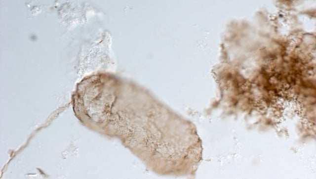 1.75-Billion-Year-Old Fossilized Cells Are Oldest Evidence For Photosynthesis In Cyanobacteria