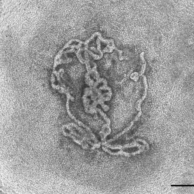 A bright field image of a testicular organoid created from mouse embryos and incubated in a dish for 14 days showing the tubular structures formed in the dish.