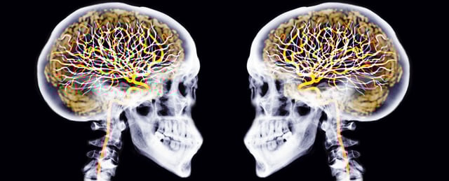 Two Skulls With Brains And Neurons