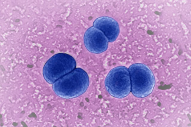 Meningococcus, Neisseria meningitidis, seen under a scanning electron microscope. (Photo by: BSIP/Universal Images Group via Getty Images)