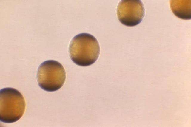 This 1966 microscope photo shows five colonies of Group-B Neisseria meningitidis bacteria. The CDC issued an alert Thursday to U.S. doctors about an increase in cases of one type of invasive meningococcal disease, mostly due to the serogroup Y strain of the bacteria. 