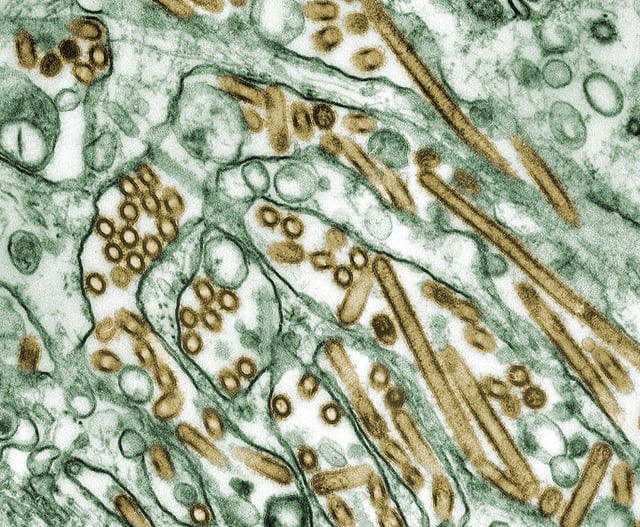 Digitally-colorized transmission electron microscopic image of Avian Influenza A H5N1 virus particles (seen in gold), grown in Madin-Darby Canine Kidney (MDCK) epithelial cells (seen in green).