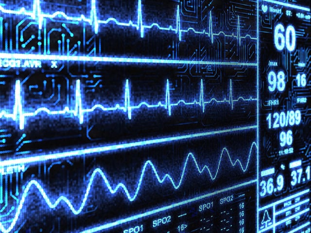 Cardiac Monitor