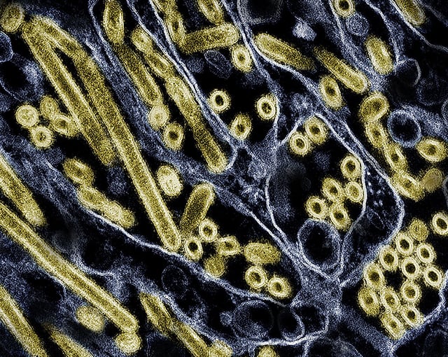 Colorized transmission electron micrograph of avian influenza A H5N1 virus particles (gold), grown in Madin-Darby Canine Kidney (MDCK) epithelial cells.