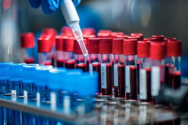 The team are now continuing to follow up on those predicted to develop Parkinson’s, to further verify the accuracy of the test. Credit: Neuroscience News