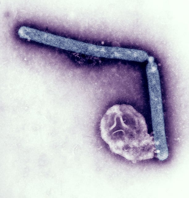This Transmission Electron Micrograph Tem, Taken At A Magnification Of 108,000X, Revealed The Ultrastructural Details Of Two Avian Influenza A H5N1 Virions, A Type Of Bird Flu Virus, Which Is A Subtype Of Avian Influenza A. At This Magnification, One May Note The Stippled Appearance Of The Roughened Surface Of The Proteinaceous Coat Encasing Each Virion. Although This Virus Does Not Typically Infect Humans, In 1997, The First Instance Of Direct Bird To Human Spread Of Influenza A H5N1 Virus Was Documented During An Outbreak Of Avian Influenza Among Poultry In Hong Kong. The Virus Caused Severe Respiratory Illness In 18 People, Of Whom, 6 Had Died. Since That Time, There Have Been Other Instances Of H5N1 Infection Among Humans. During August To October, 2004, Sporadic Human Cases Of Avian Influenza A H5N1 Were Reported In Vietnam And Thailand. Since December, 2004, A Resurgence Of Poultry Outbreaks And Human Cases Has Been Reported In Vietnam. On February 2, 2005, The First Of Four Human Cases Of H5N1 Infection From Cambodia Was Reported. On July 21, 2005, The First Human Case Of H5N1 In Indonesia Was Reported, And Since Then Indonesia Has Continued To Report Human Cases In August, September, And October, 2005. (Photo By BSIP/UIG Via Getty Images)