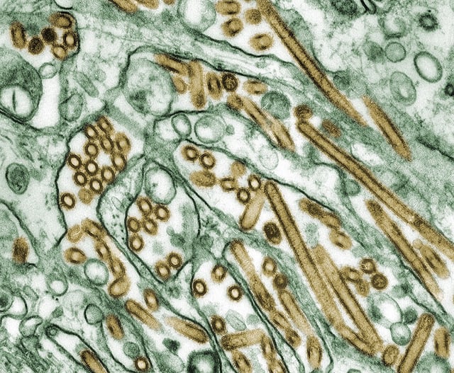Bird flu poses a threat to some farm workers. (Photo by Smith Collection/Gado/Getty Images).