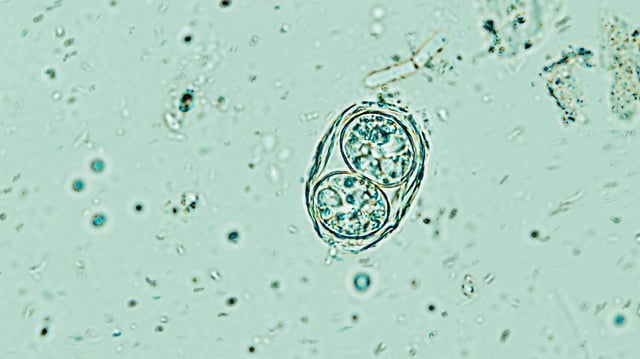 'Toxoplasma gondii' seen under a microscope.