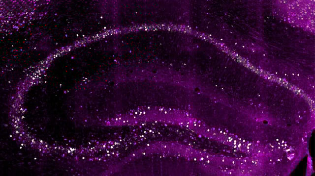 Cross-section through the hippocampus of a mouse: Early-born neurons (magenta) create a long-persisting copy of a memory. (Image: University of Basel, Biozentrum)