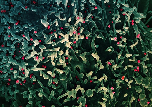 Monkeypox Virus Colorized scanning electron micrograph of mpox virus (red) on the surface of infected VERO E6 cells (green). Image captured at the NIAID Integrated Research Facility (IRF) in Fort Detrick, Maryland. Credit: NIAID/NIH