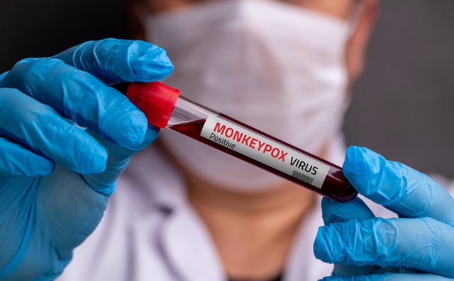 Mpox test