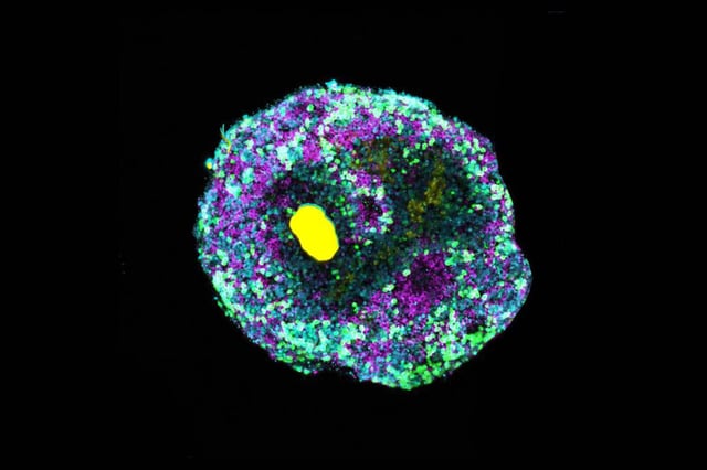 Retinal organoid with a microscopically small bead of DNA (yellow) and various retinal cell types (green, cyan, magenta). | © Cassian Afting, AG Wittbrodt