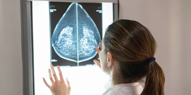 About one in eight women in the U.S. will develop invasive breast cancer over the course of her lifetime.