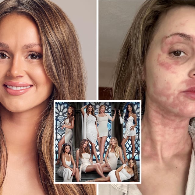 Mikayla Matthews, 24, shared photos from her chronic illness battle Sunday on Instagram.